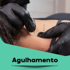 Agulhamento-Agulhas-Dry-Needling-Acupuntura