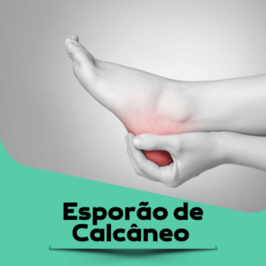 esporao-de-calcaneo