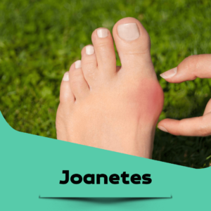joanete