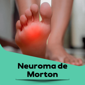 neuroma-de-morton